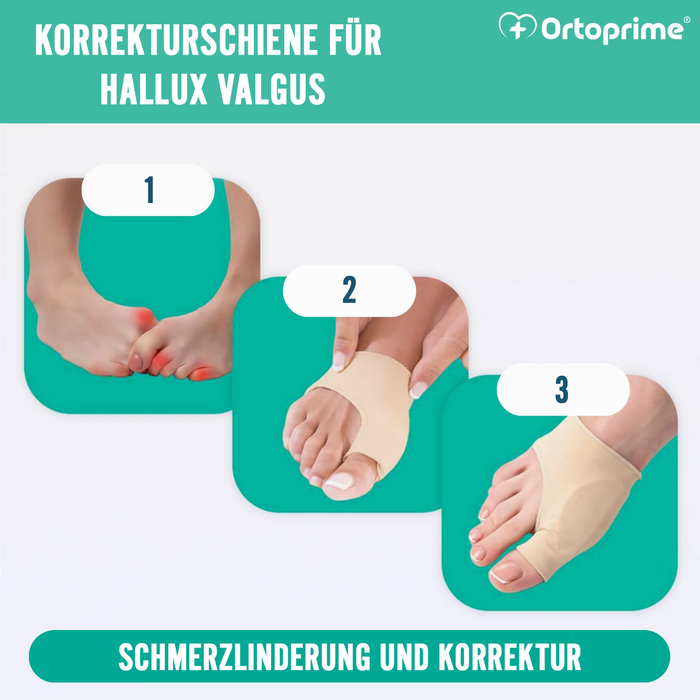 Komplettes Korrekturset für Hallux Valgus | 7-teilig