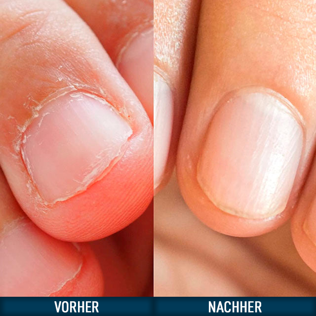 Anti-Nagelkau-Lack mit Bittergeschmack
