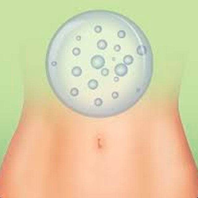 comprimidos-para-gases-intestinales-ortoprime